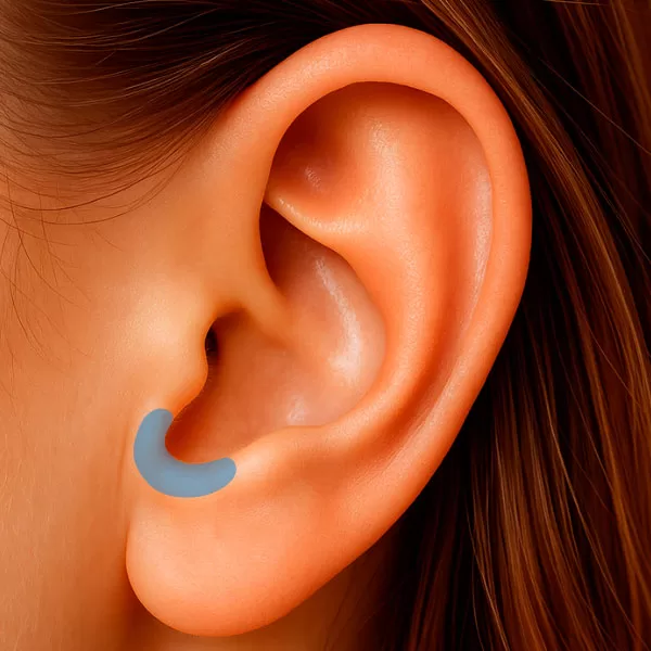 Região da Incisura Intertrágica da orelha – região anatômica utilizada na auriculoterapia.