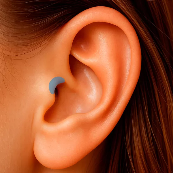 Região da Incisura Supratrágica da orelha – região anatômica utilizada na auriculoterapia.