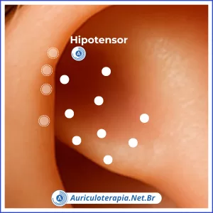 Hipotensor