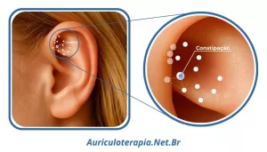 Ponto Constipação localizado na Fossa Triangular da orelha, utilizado na auriculoterapia como ponto para tratamento da constipação.