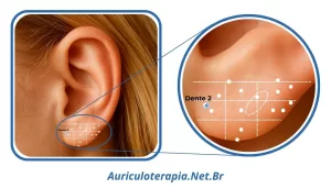 Ponto Dente 2 localizado no Lóbulo da orelha, utilizado na auriculoterapia para tratar dores de dente.