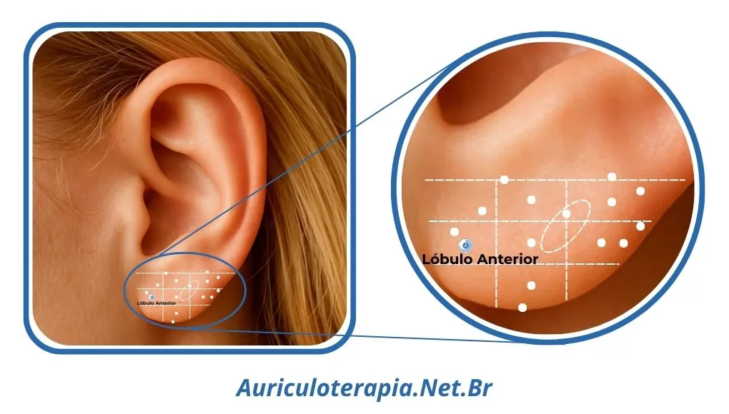 Ponto Lóbulo Anterior localizado no Lóbulo da orelha, utilizado na auriculoterapia em casos de neurastenia e distúrbios do sono.