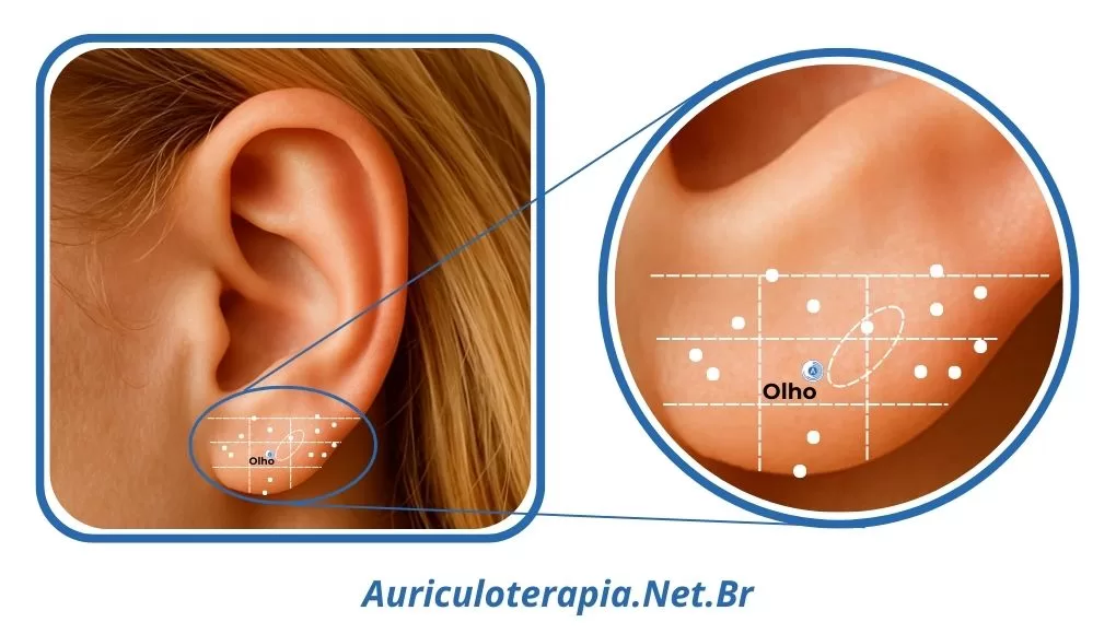 Ponto do Olho localizado no Lóbulo da orelha, utilizado na auriculoterapia para tratar distúrbios visuais.