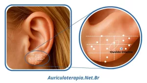Ponto Ouvido Interno localizado no Lóbulo da orelha, utilizado na auriculoterapia para tratar dores de ouvido e otites.