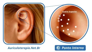 Ponto Ovário Superior localizado na Fossa Triangular da orelha, utilizado na auriculoterapia para o tratamento de problemas menstruais.