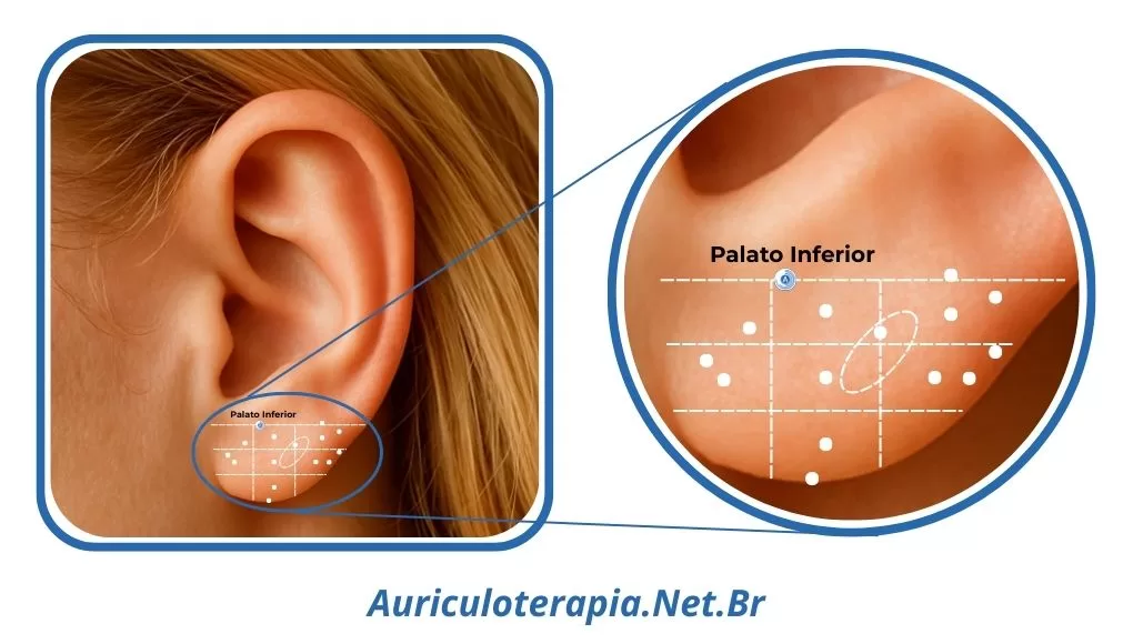 Ponto Palato Inferior localizado no Lóbulo da orelha, utilizado na auriculoterapia para tratar afecções da cavidade bucal.