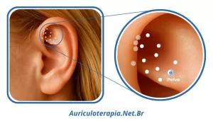 Ponto Pelve localizado na Fossa Triangular da orelha, utilizado na auriculoterapia para o tratamento de dores no baixo ventre.