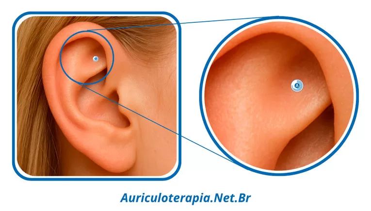 Ponto Ping Chuan Superior localizado na Fossa Triangular da orelha, utilizado na auriculoterapia para tratamentos de processos viróticos e diminuição da imunidade.