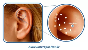 Ponto ShenMen localizado na Fossa Triangular da orelha, utilizado na auriculoterapia como ponto sedante, anti-inflamatório e analgésico.