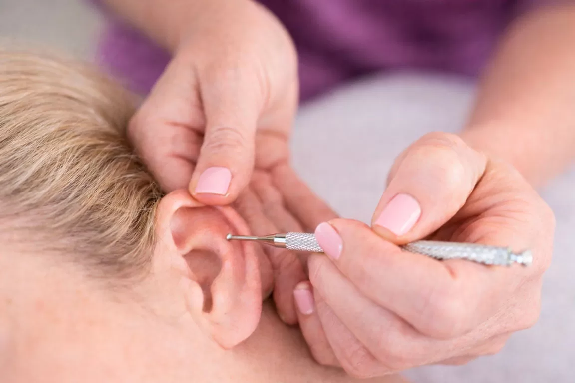 leitura do pavilhão auricular na auriculoterapia.