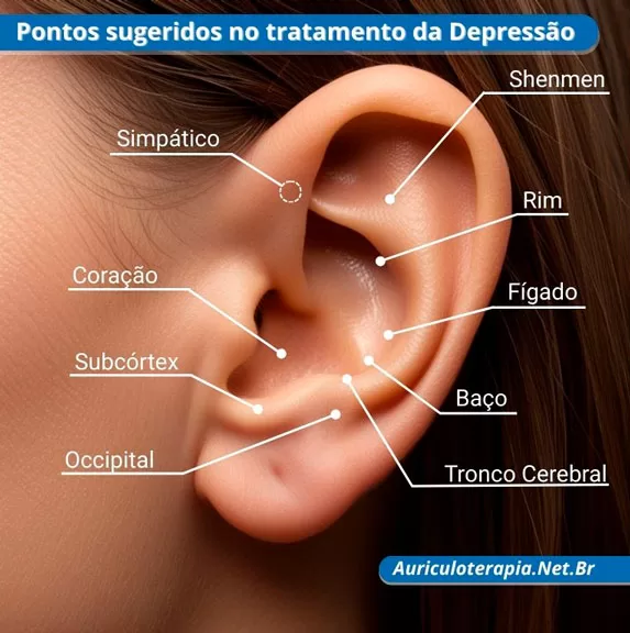 Pontos sugeridos no tratamento de depressão na Auriculoterapia.