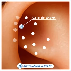 Colo do Útero