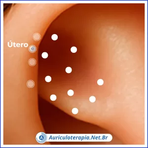 Útero